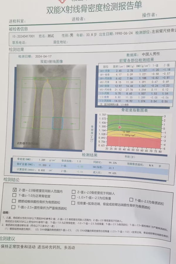 雙能X射線骨密度儀：準確測量骨密度，助力骨質疏松防治，守護骨骼健康